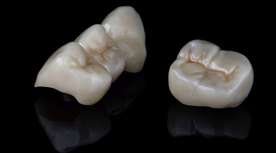 Zirconium Crowns
