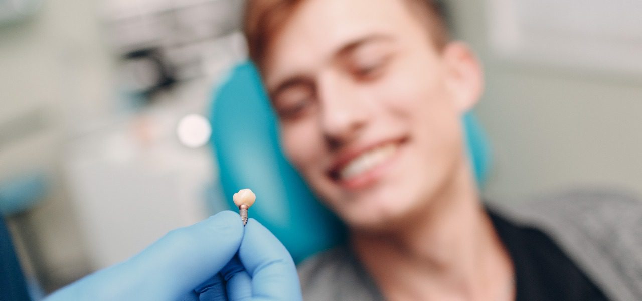 Dental Implants for a Smile