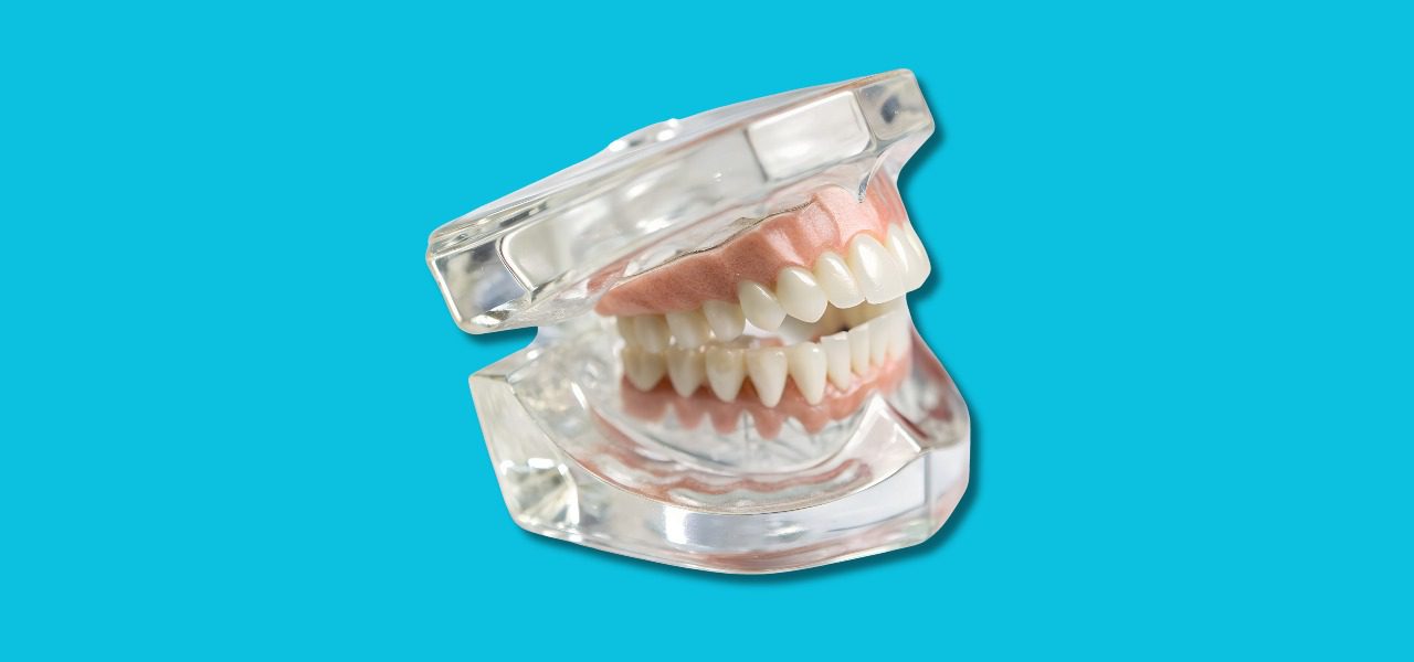 How many teeth are needed for a smile makeover