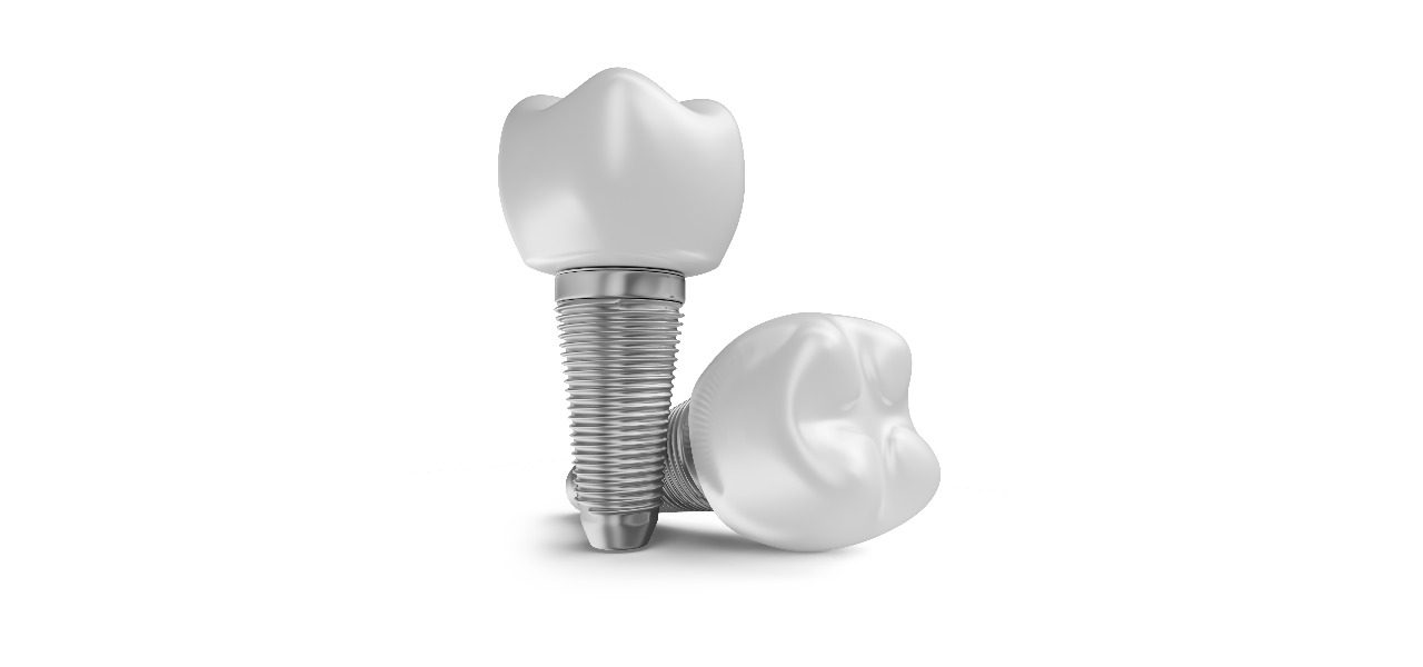 Dental Implants 2025 in Turkey