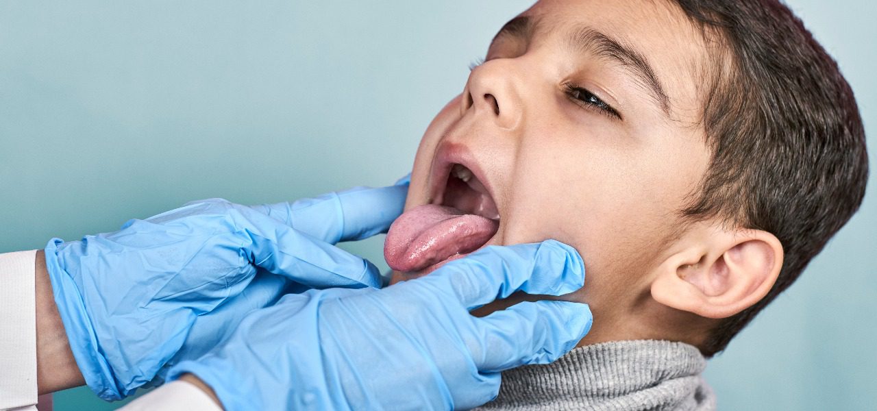 Infection-Related Ulcers