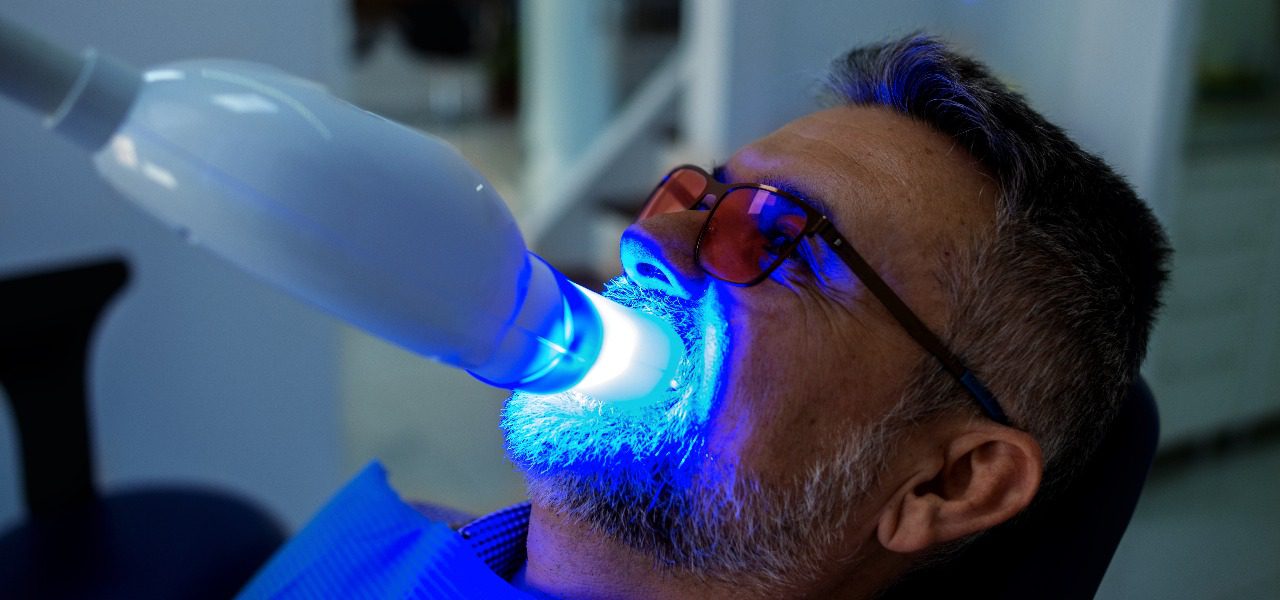 Teeth Whitening 2025