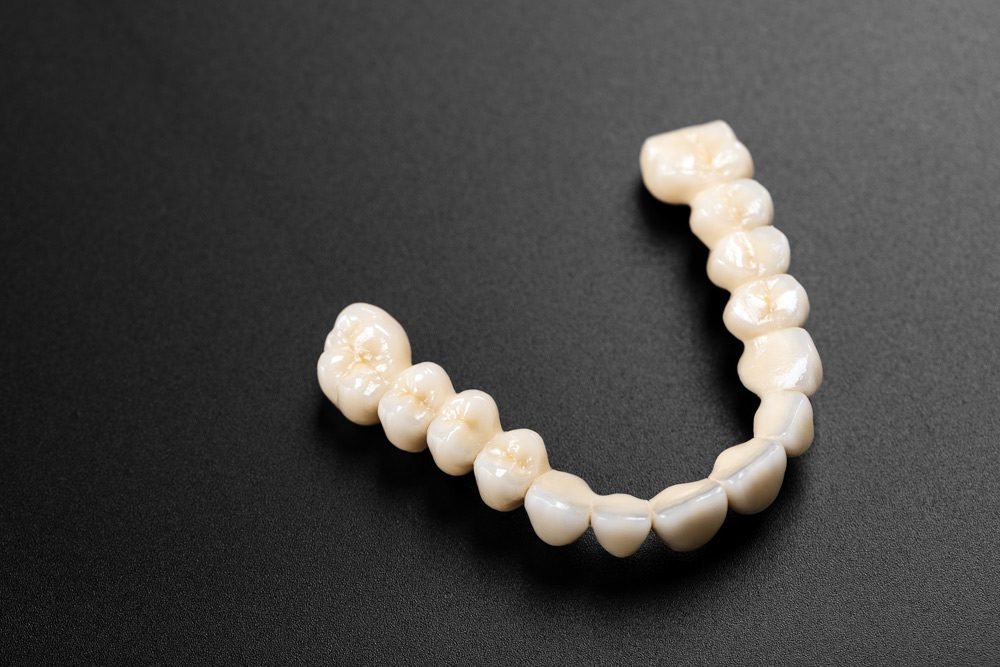 Dental crown result at Dr Cem Baysal's Istanbul clinic