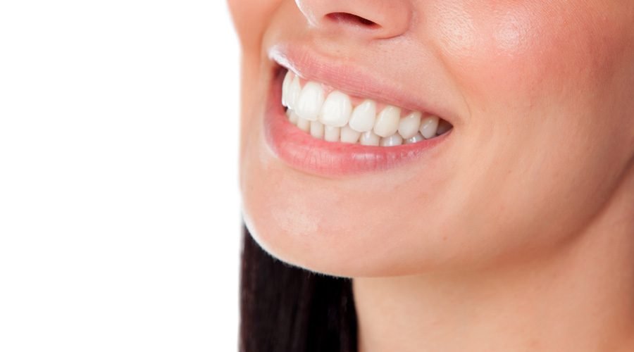 Porcelain Veneers in Turkey