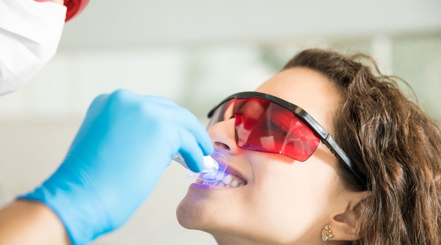 purple teeth whitening