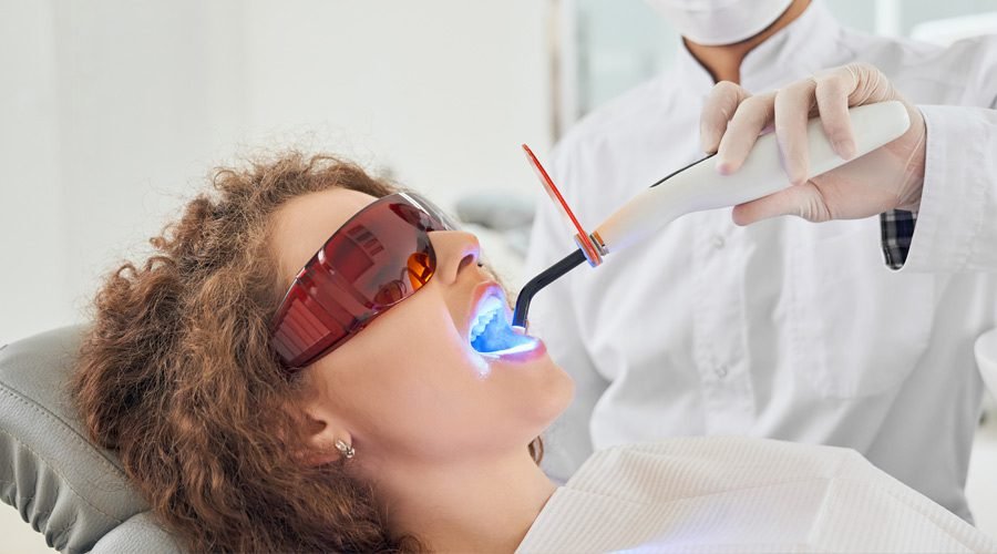 smile teeth whitening