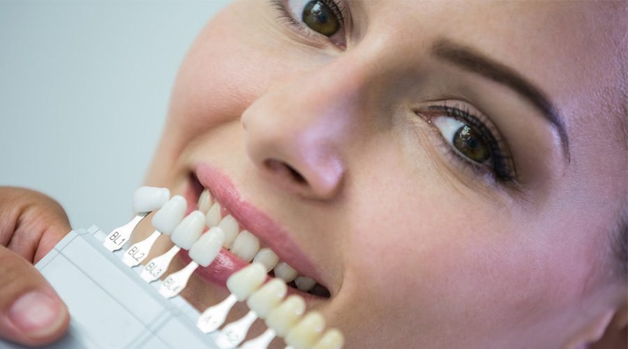 Porcelain Crowns in Turkey