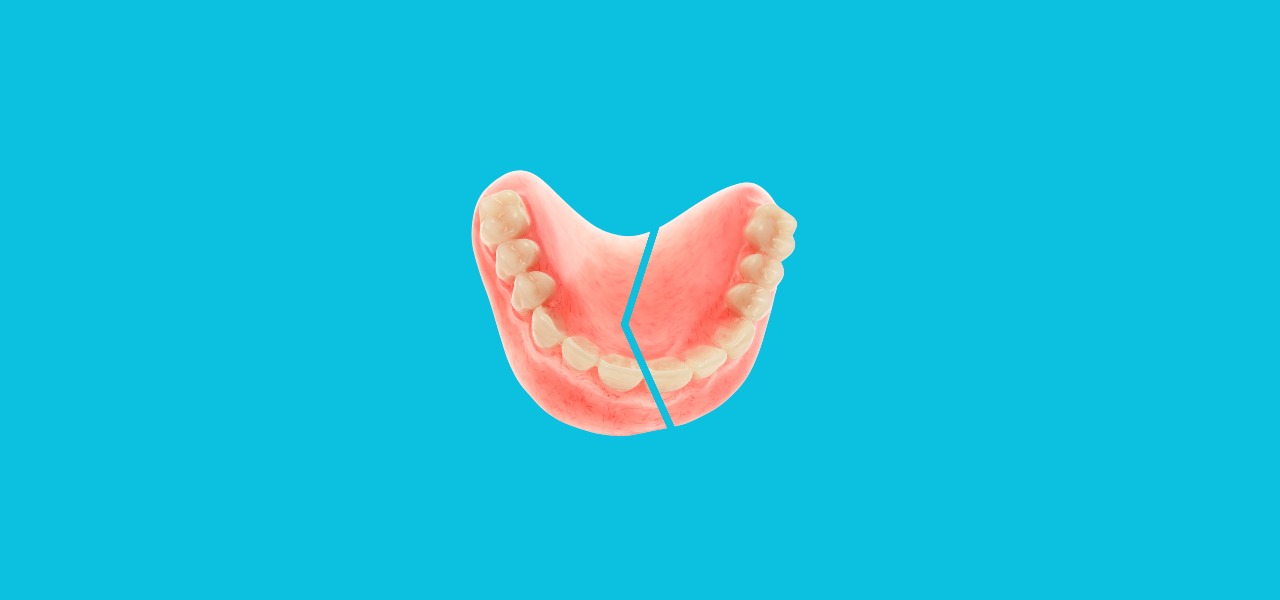 Durable teeth