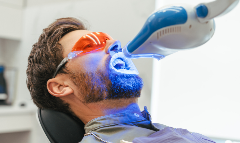 Hollywood Teeth Whitening