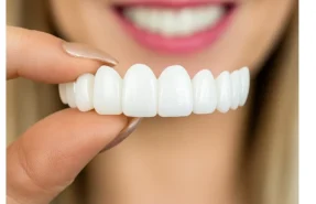 Best Snap-On Veneers for Missing Teeth